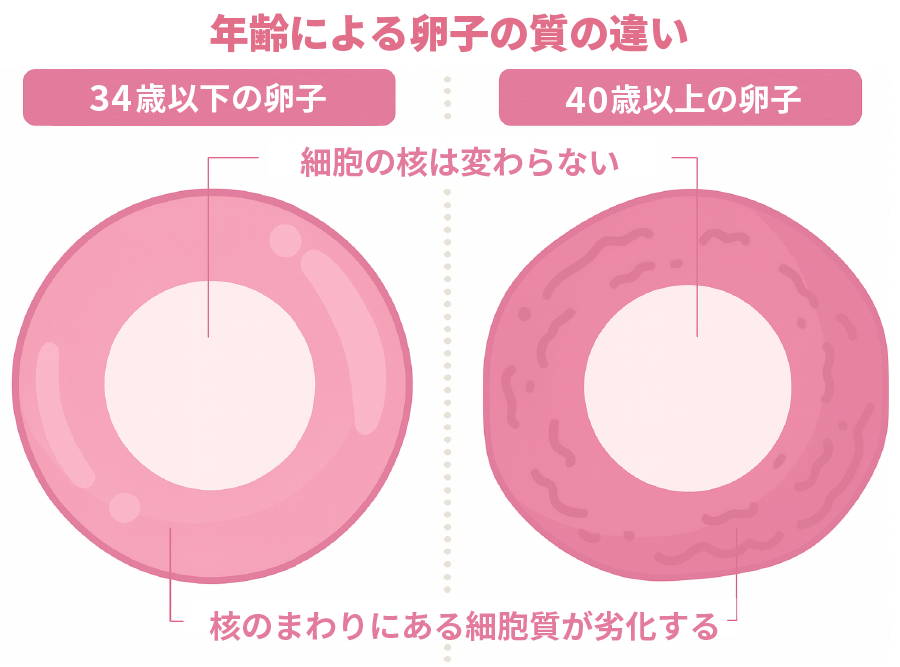 年齢による卵子の質の違い