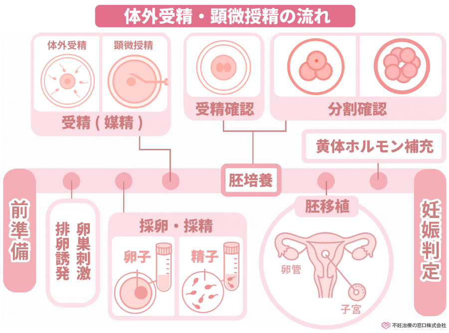 体外受精・顕微授精の流れ