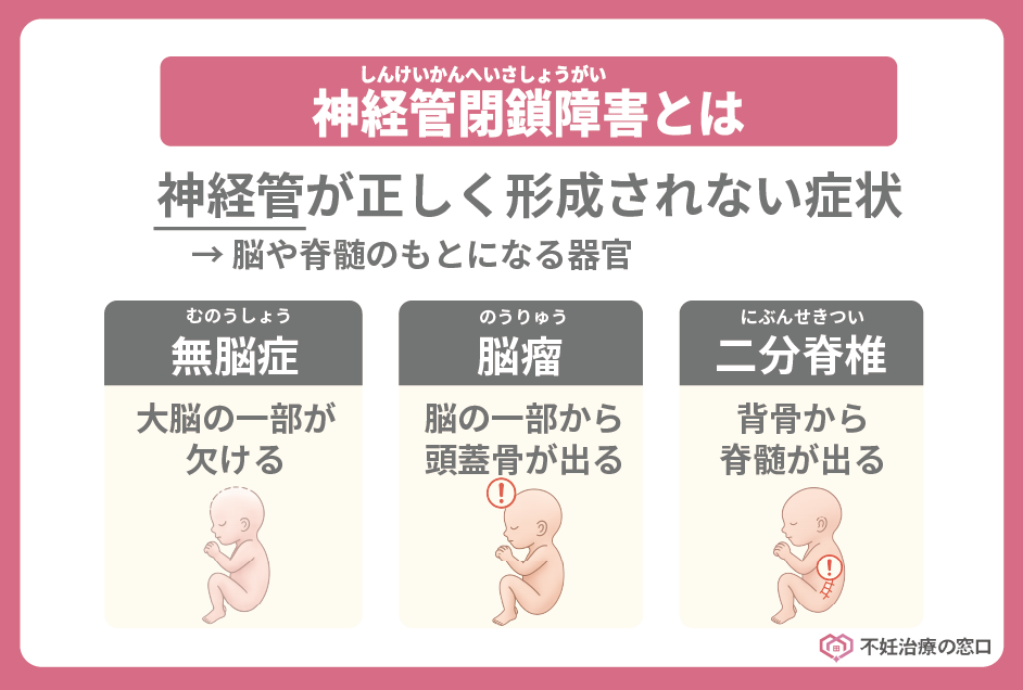 神経管閉鎖障害とは