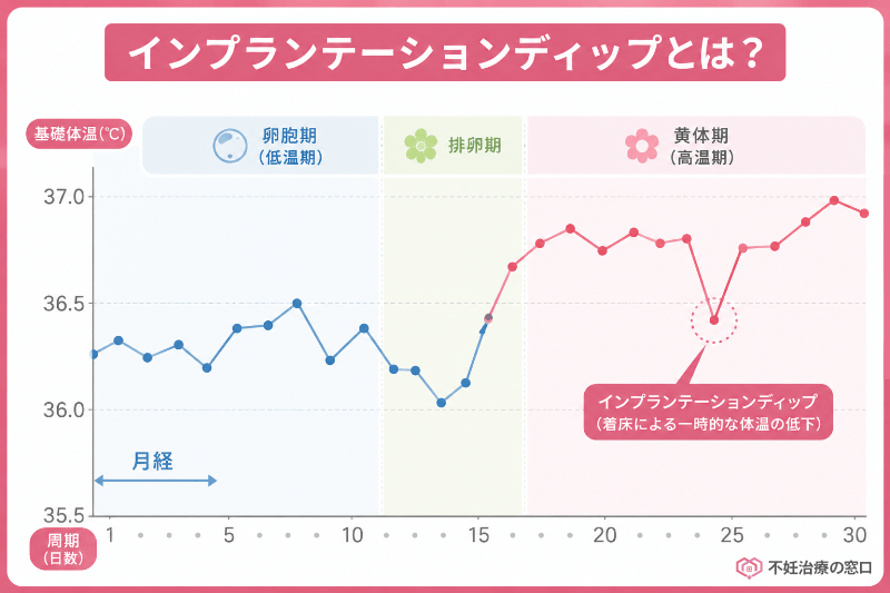 インプランテーションディップとは