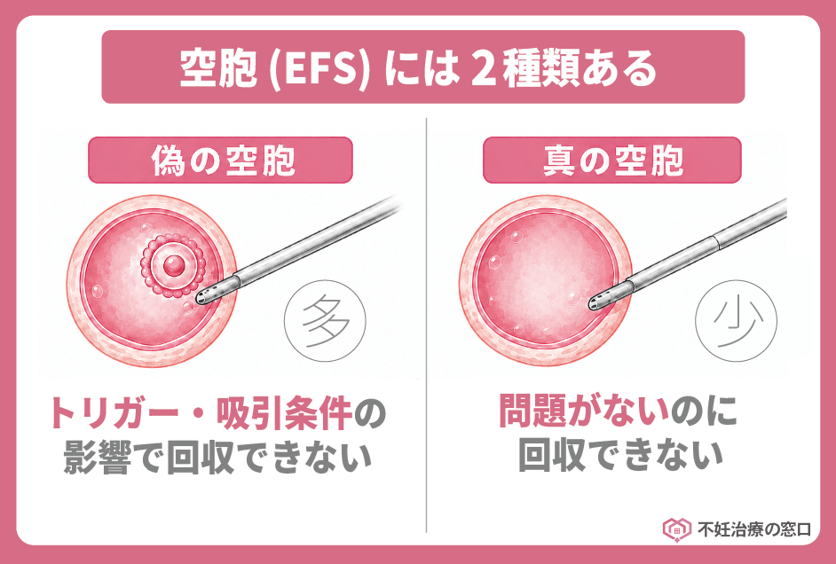 空胞の種類