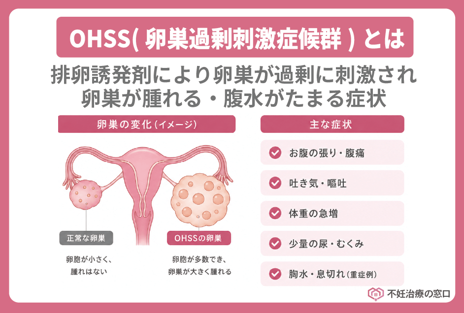 卵巣過剰刺激症候群(OHSS)とは