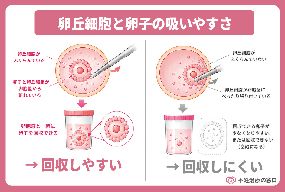 卵丘細胞と卵子の吸いやすさ